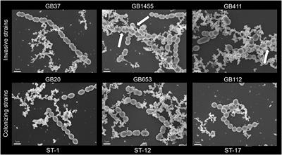 Production and Composition of Group B Streptococcal Membrane Vesicles Vary Across Diverse Lineages